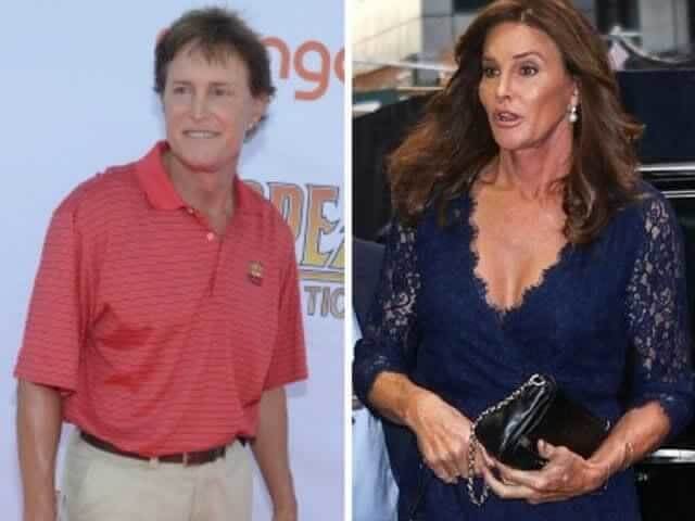 tmp0qqjdh9d Celebrities Who Spent Big on Transforming Their Looks