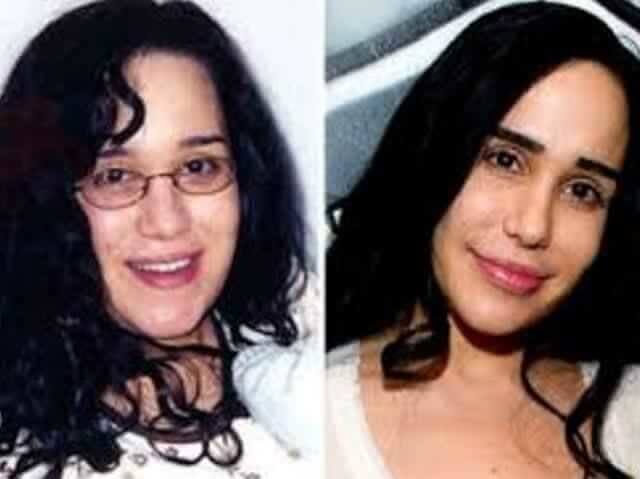 tmp0xu86phi Celebrities Who Spent Big on Transforming Their Looks