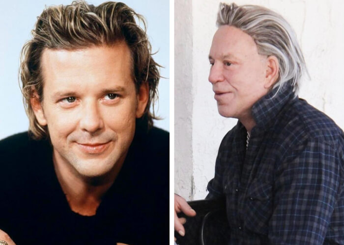 tmp0ythf0sy Celebrities Who Spent Big on Transforming Their Looks