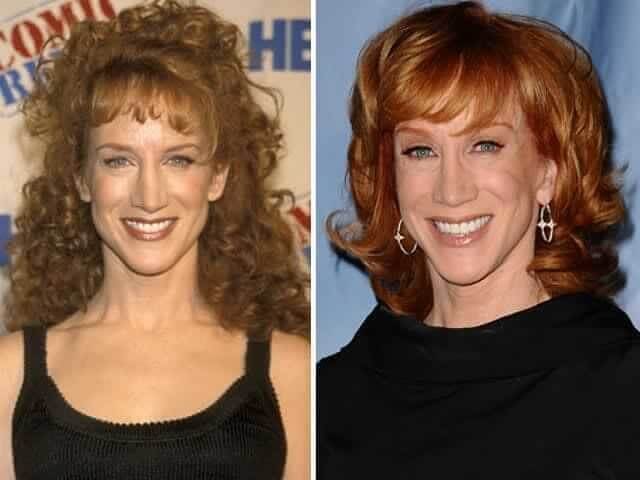 tmp12fuo07m Celebrities Who Spent Big on Transforming Their Looks