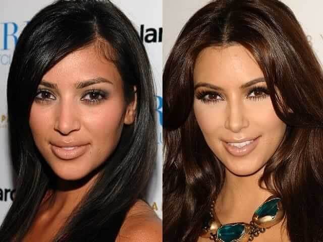 tmp1foealru Celebrities Who Spent Big on Transforming Their Looks