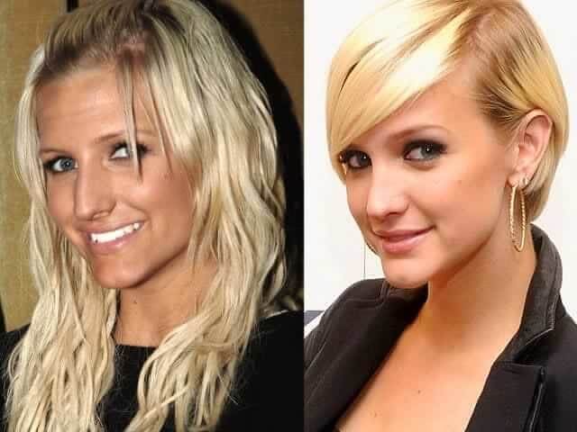 tmp1slrx8cz Celebrities Who Spent Big on Transforming Their Looks
