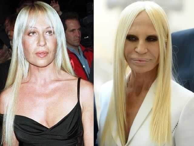 tmp1uz5a4jz Celebrities Who Spent Big on Transforming Their Looks