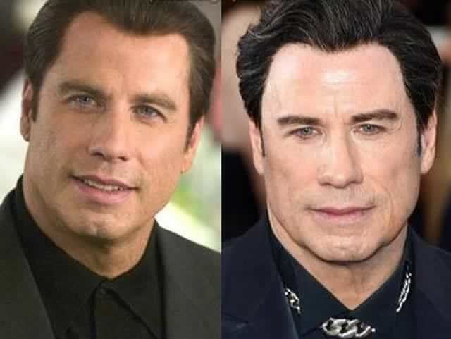 tmp2jo7b06j Celebrities Who Spent Big on Transforming Their Looks
