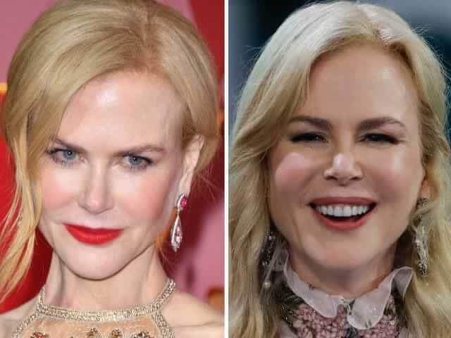 tmp31alrvli Celebrities Who Spent Big on Transforming Their Looks