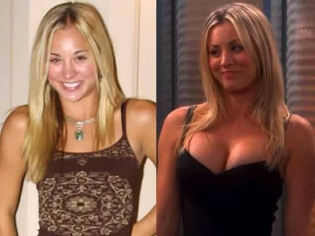 tmp4d508p93 Celebrities Who Spent Big on Transforming Their Looks