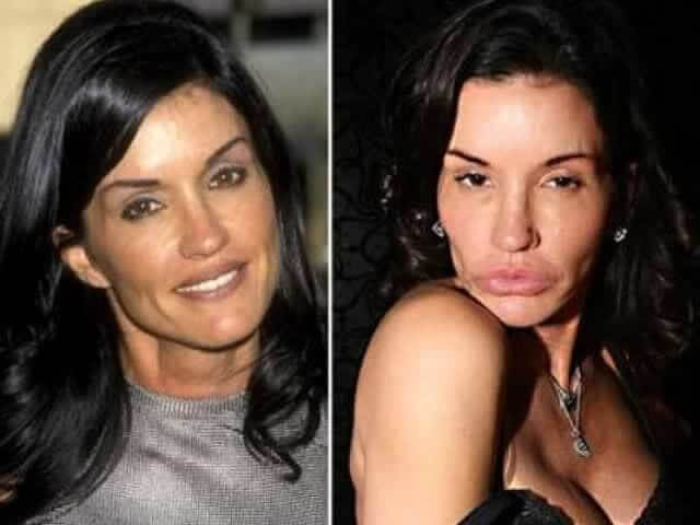 tmp51gsgyo8 Celebrities Who Spent Big on Transforming Their Looks