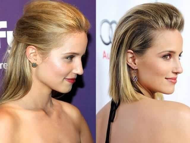 tmp66mp_awn Celebrities Who Spent Big on Transforming Their Looks