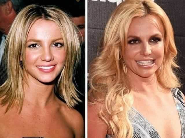 tmp6in34217 Celebrities Who Spent Big on Transforming Their Looks