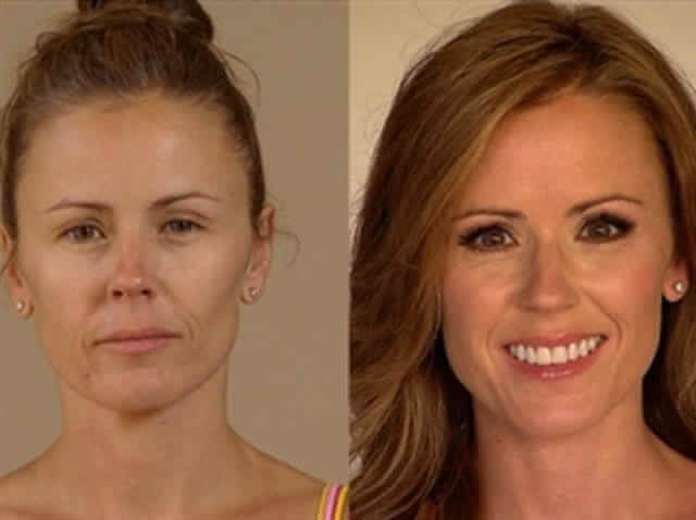 tmp7irrwc6v Celebrities Who Spent Big on Transforming Their Looks