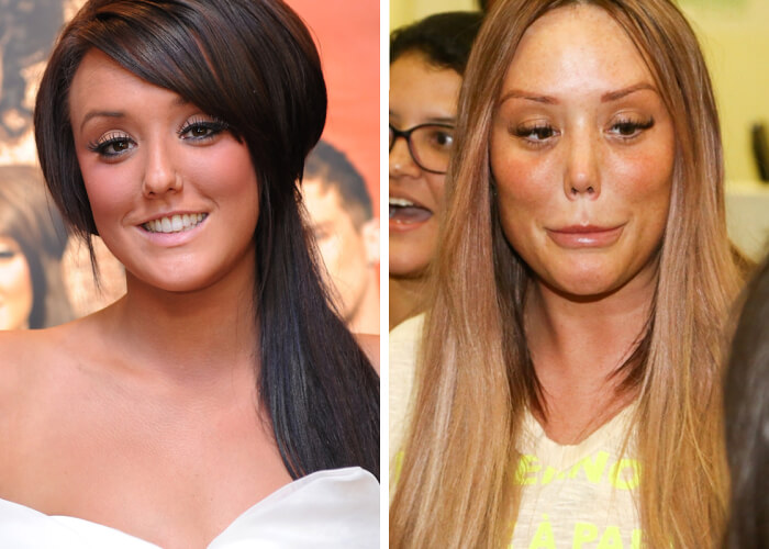 tmp7rfswazm Celebrities Who Spent Big on Transforming Their Looks