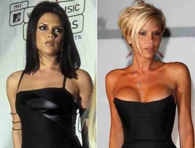 tmp97gyysnz Celebrities Who Spent Big on Transforming Their Looks