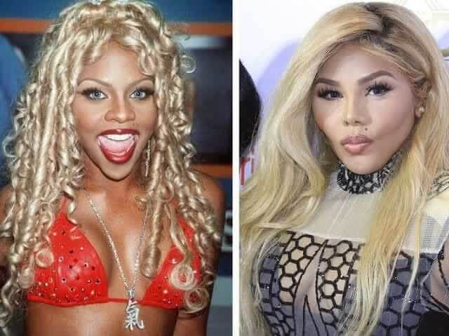 tmp9kgyrqtd Celebrities Who Spent Big on Transforming Their Looks