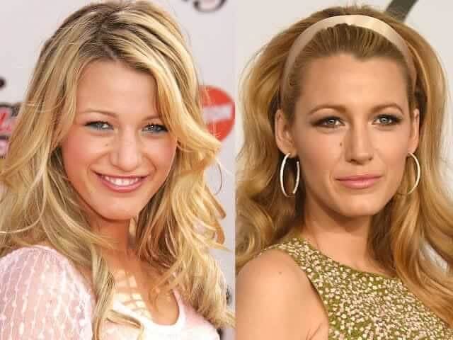 tmpahdfnjh_ Celebrities Who Spent Big on Transforming Their Looks