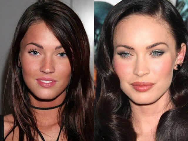 tmpapqm5ymb Celebrities Who Spent Big on Transforming Their Looks