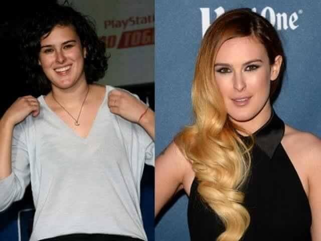 tmpav9o1z0v Celebrities Who Spent Big on Transforming Their Looks