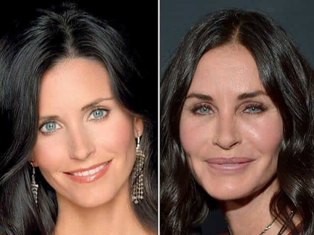 tmpbblrkuho Celebrities Who Spent Big on Transforming Their Looks