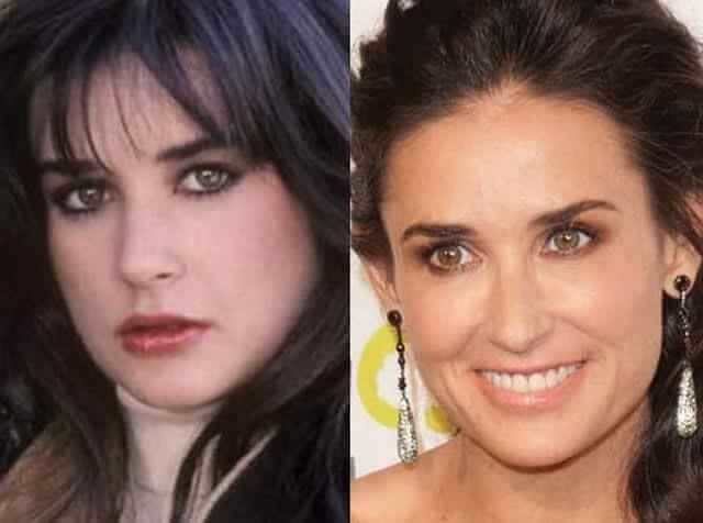 tmpcezsqchy Celebrities Who Spent Big on Transforming Their Looks