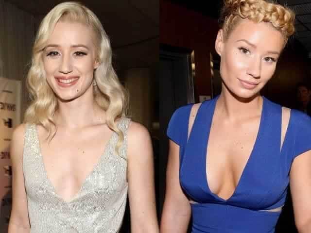 tmpcku6f8wb Celebrities Who Spent Big on Transforming Their Looks