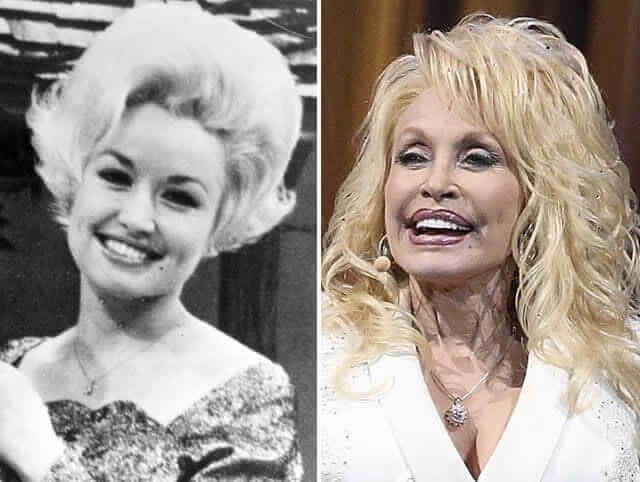 tmpdcxyirt2 Celebrities Who Spent Big on Transforming Their Looks