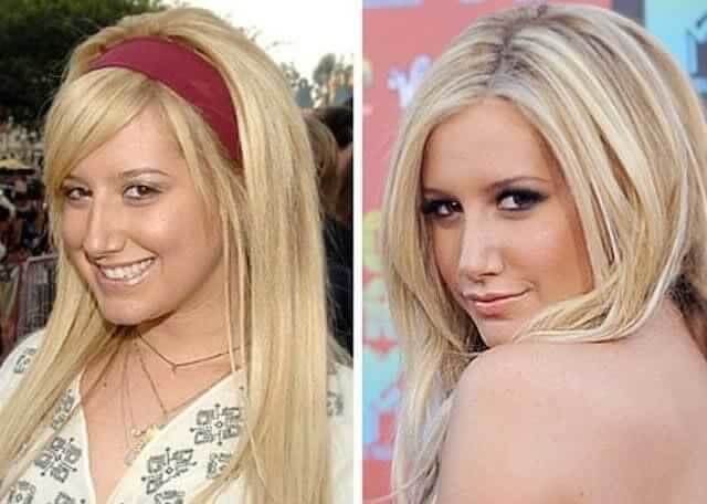 tmpdo90pxg7 Celebrities Who Spent Big on Transforming Their Looks