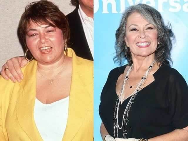 tmpeal7y6xo Celebrities Who Spent Big on Transforming Their Looks