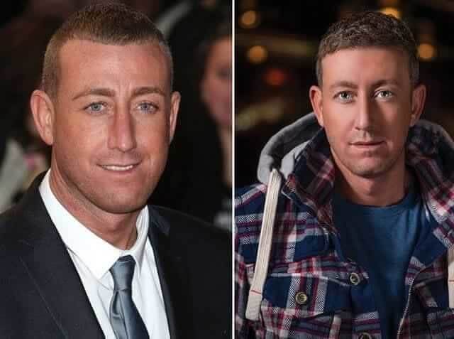 tmpgc5hjf0h Celebrities Who Spent Big on Transforming Their Looks