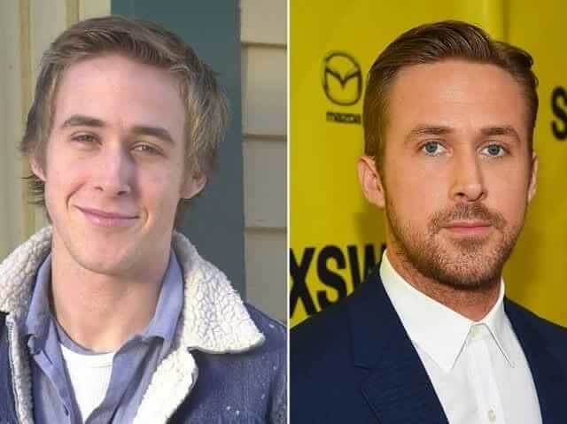 tmph9ttd6rs Celebrities Who Spent Big on Transforming Their Looks