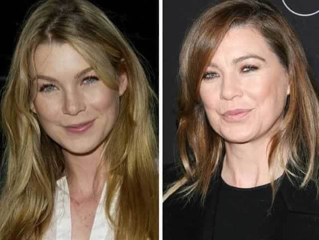 tmphvku4dhs Celebrities Who Spent Big on Transforming Their Looks