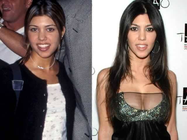 tmpiv19vncy Celebrities Who Spent Big on Transforming Their Looks
