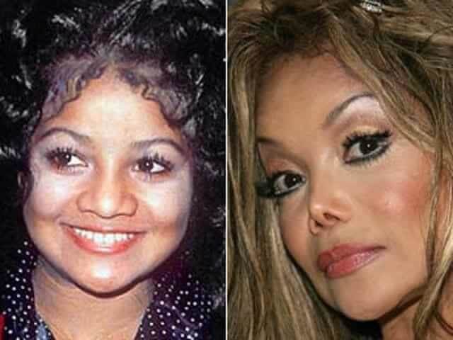 tmpj8hwp6e3 Celebrities Who Spent Big on Transforming Their Looks