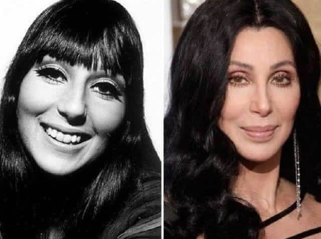 tmpjevg4mn7 Celebrities Who Spent Big on Transforming Their Looks