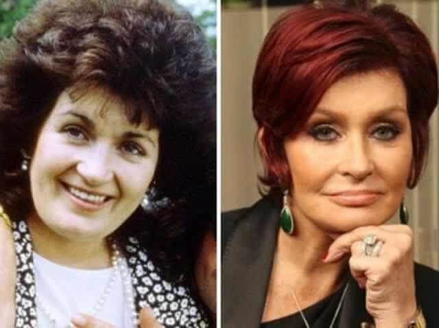 tmpjgra97bs Celebrities Who Spent Big on Transforming Their Looks