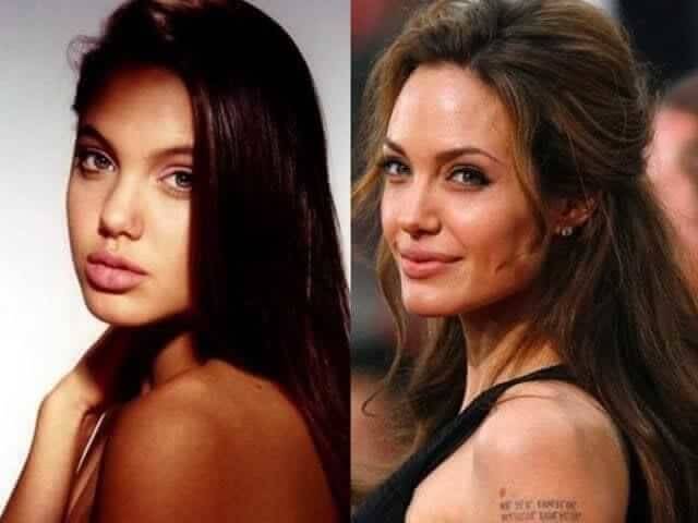 tmpjydk88j7 Celebrities Who Spent Big on Transforming Their Looks
