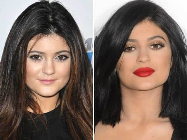 tmpmp86_lli Celebrities Who Spent Big on Transforming Their Looks