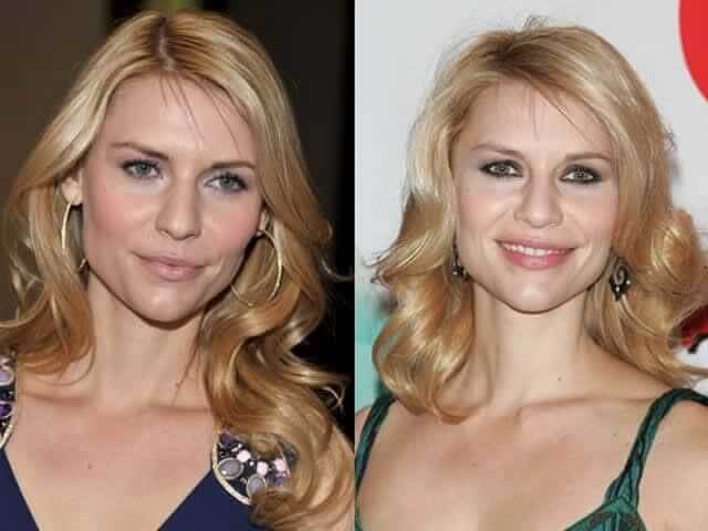 tmpmruqwjdy Celebrities Who Spent Big on Transforming Their Looks