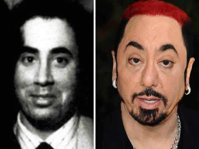 tmpmsqgwje7 Celebrities Who Spent Big on Transforming Their Looks