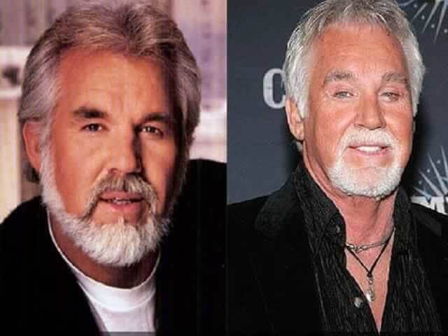 tmpnih7v1rm Celebrities Who Spent Big on Transforming Their Looks
