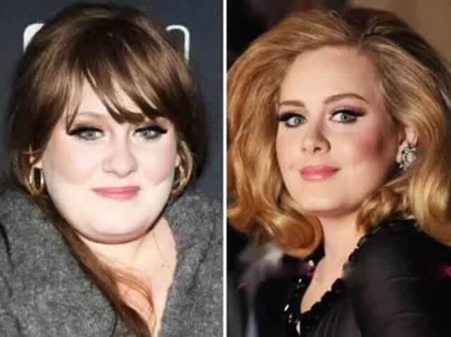 tmpo2lfchb5 Celebrities Who Spent Big on Transforming Their Looks