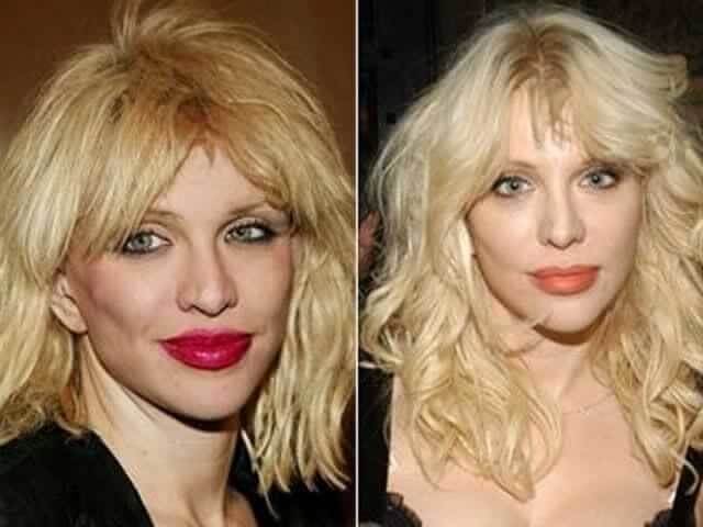 tmpouu_20ab Celebrities Who Spent Big on Transforming Their Looks