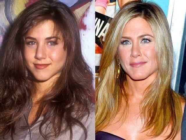 tmpov9jucm8 Celebrities Who Spent Big on Transforming Their Looks
