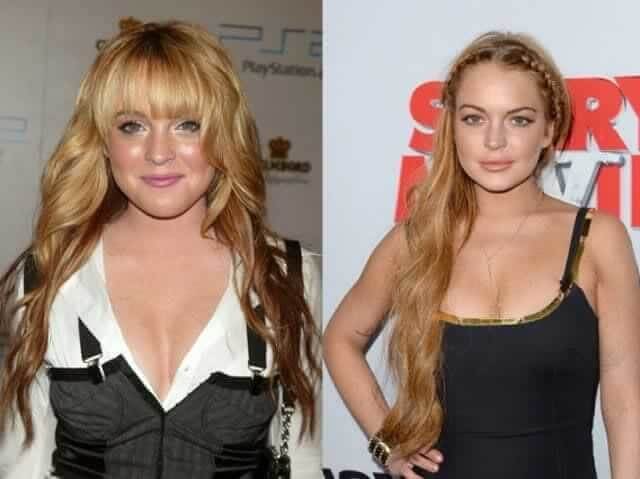 tmpowg8q783 Celebrities Who Spent Big on Transforming Their Looks