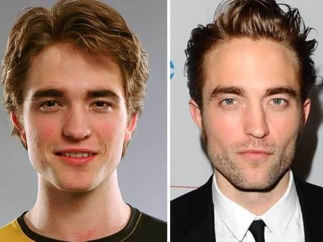 tmpp4hvjwnm Celebrities Who Spent Big on Transforming Their Looks