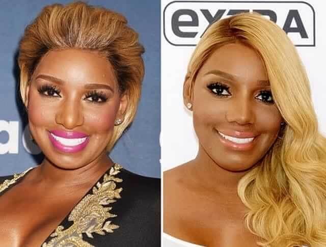 tmpp9eyc47u Celebrities Who Spent Big on Transforming Their Looks