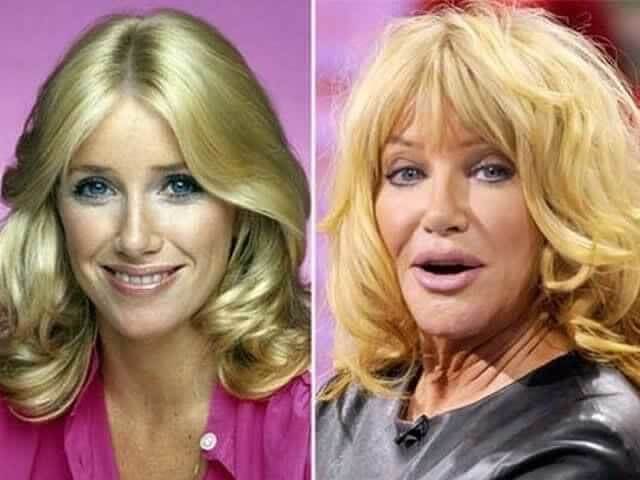 tmpphjwthld Celebrities Who Spent Big on Transforming Their Looks