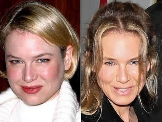 tmpscqshozt Celebrities Who Spent Big on Transforming Their Looks