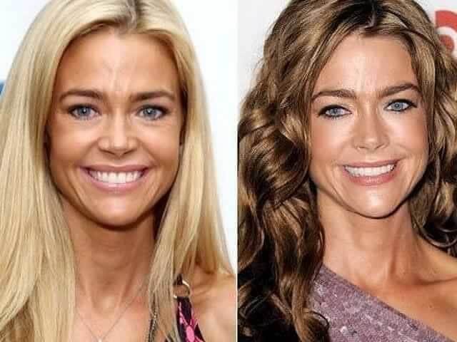tmpt2avu058 Celebrities Who Spent Big on Transforming Their Looks