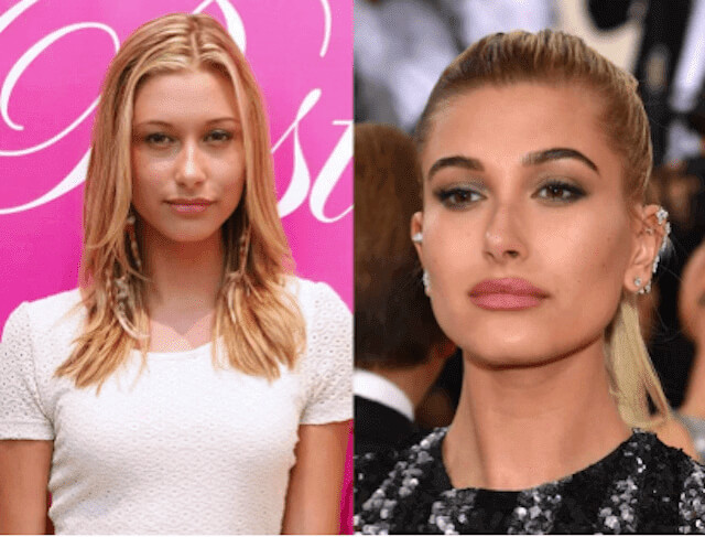 tmpt4pici3_ Celebrities Who Spent Big on Transforming Their Looks
