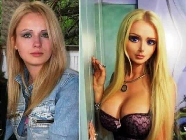 tmptfr0lotn Celebrities Who Spent Big on Transforming Their Looks