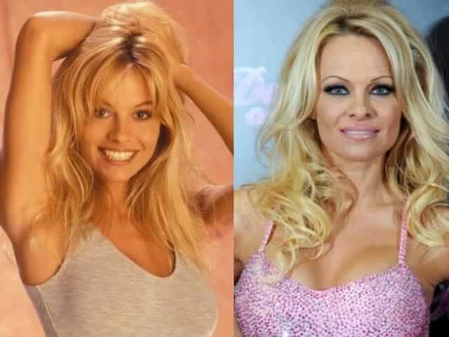 tmptve5dtqt Celebrities Who Spent Big on Transforming Their Looks